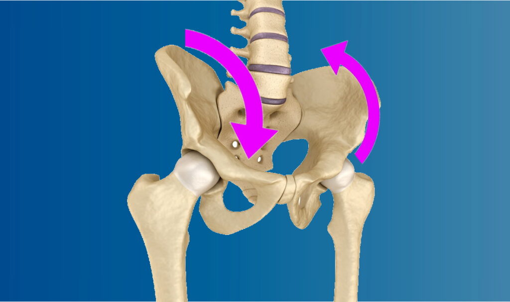 right lateral pelvic tilt