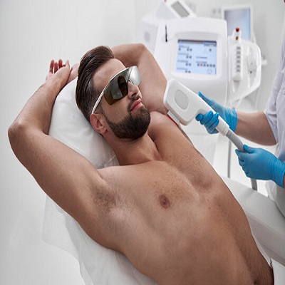 Laser Hair Removal in Islamabad