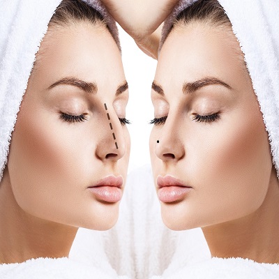 Rhinoplasty in Islamabad