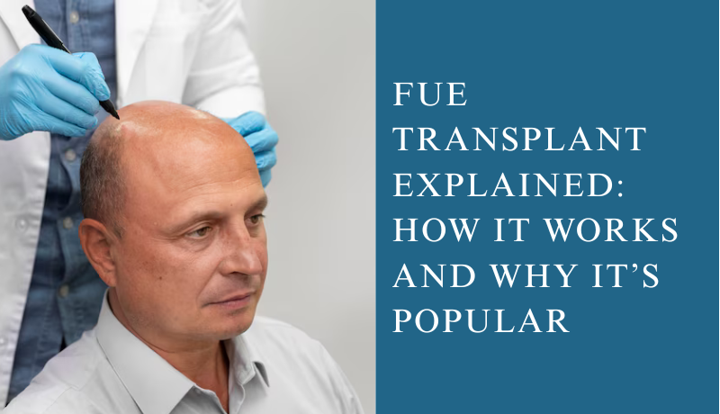 FUE transplant