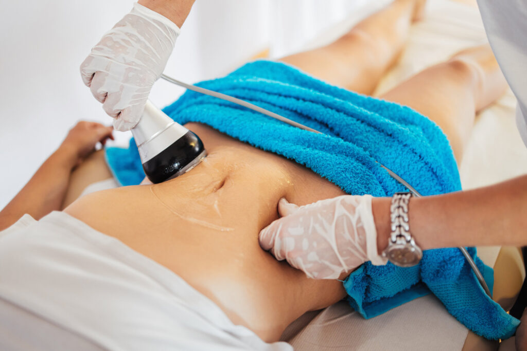 Safe and Painless Fat Reduction