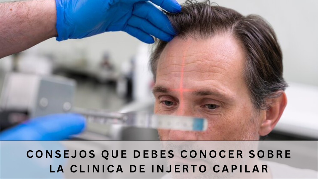 clinica de injerto capilar
