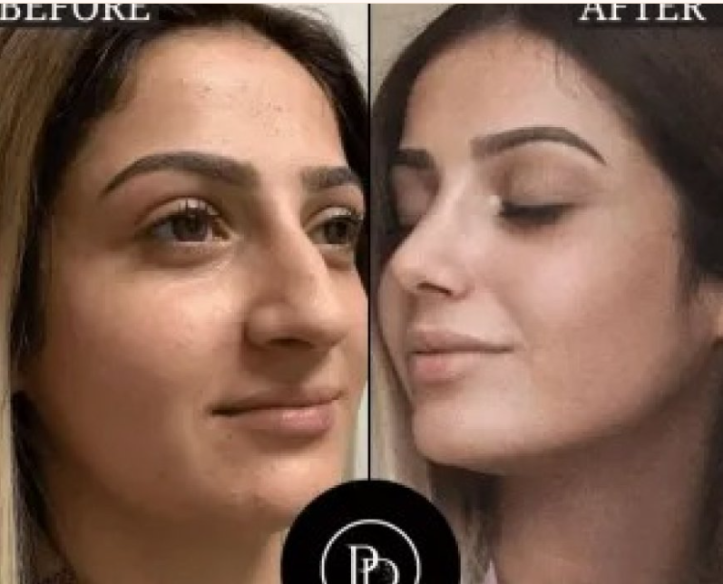 Glowing Results Start at the Best Aesthetic Clinic in Dubai
