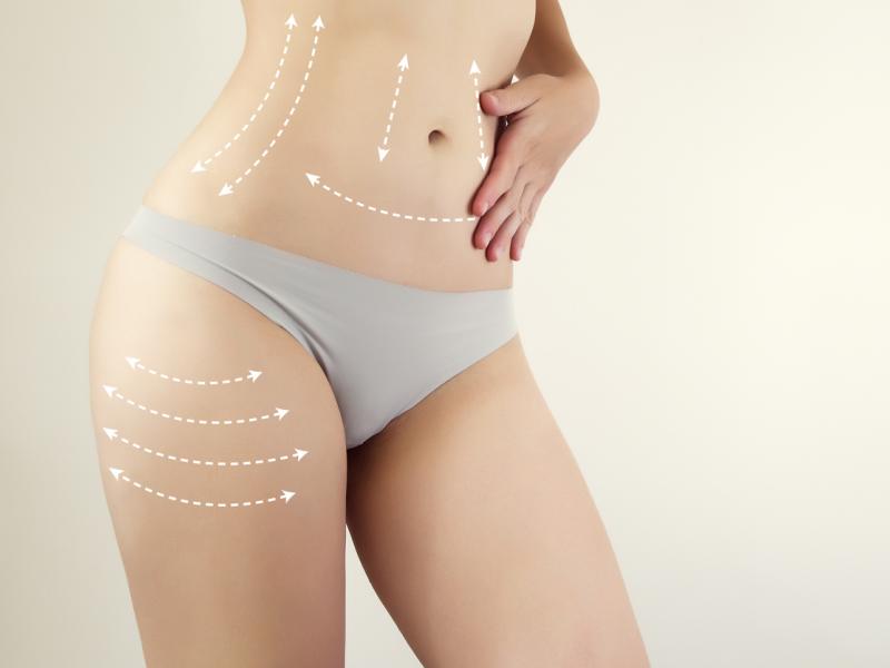 Liposuction and Aging Can It Help You Look Younger