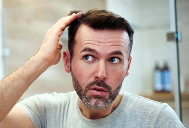 What Techniques Are Used in Scalp Micropigmentation?