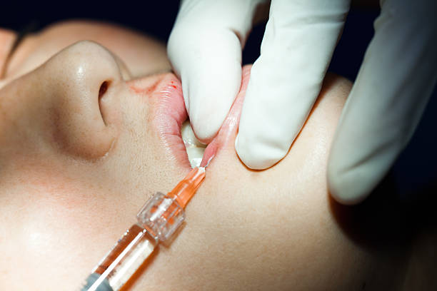 What’s the Right Volume for Lip Fillers