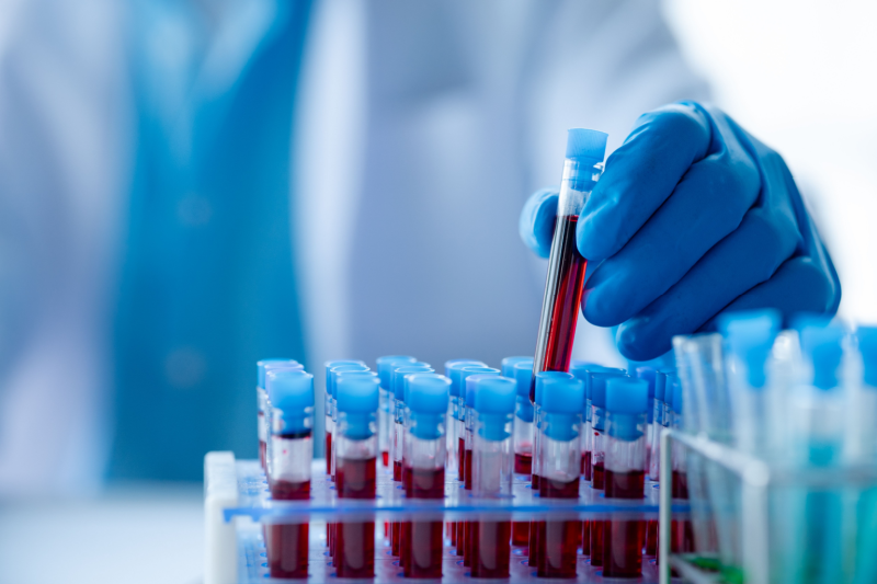 Are Blood Tests at Home Good for Detecting Toxins?