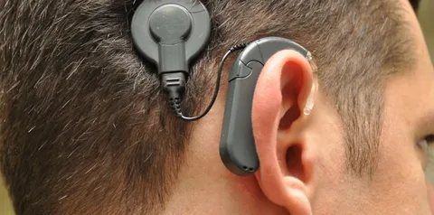 cochlear implants