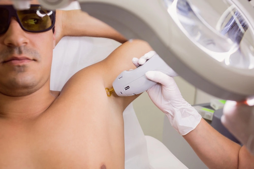 Male Laser Hair Removal Cost in Dubai