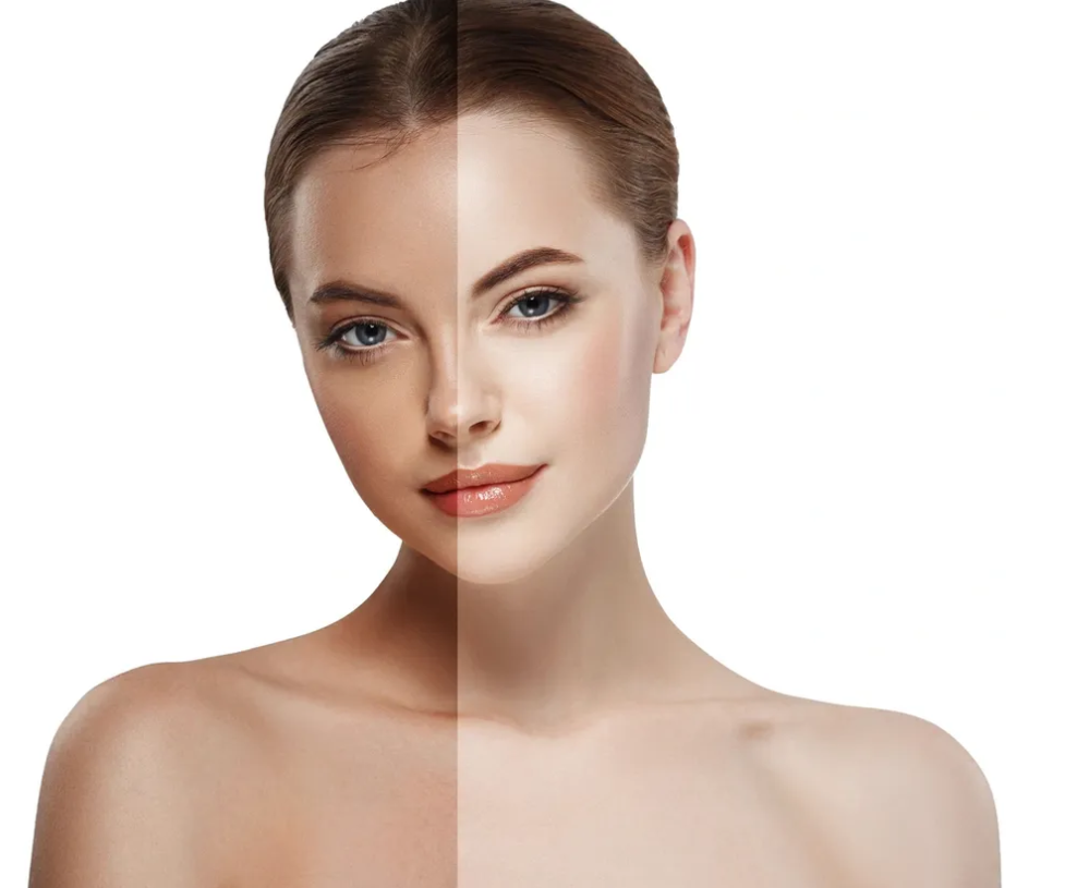 Cold Peel