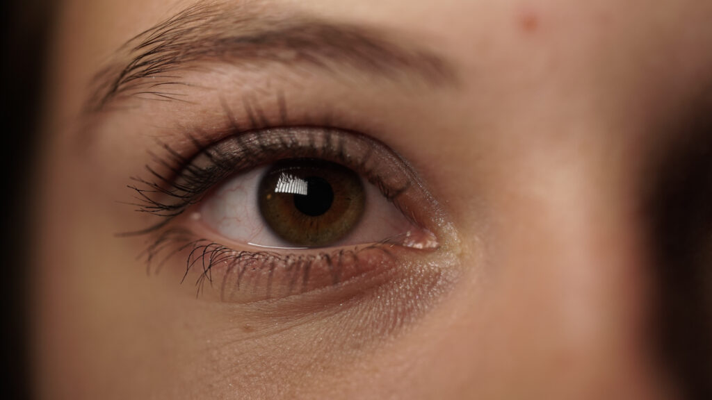 Affordable Dark Circles Treatment