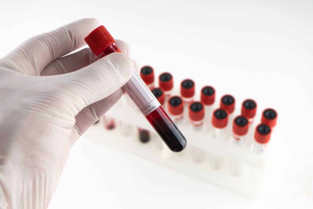 Can a Blood Test at Home Predict Heart Attacks in Advance?