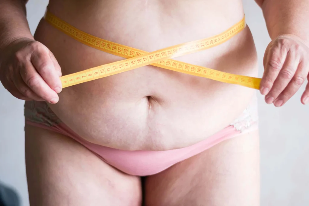 Boost Your Confidence with Lower Body Lift
