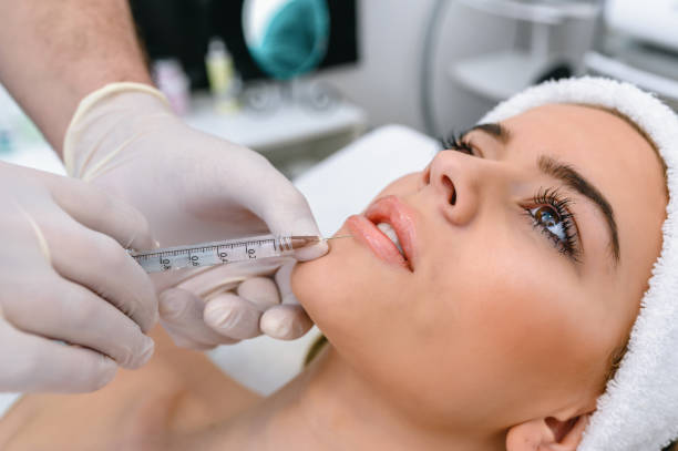 Can Russian Lip Fillers Fix Asymmetrical Lips