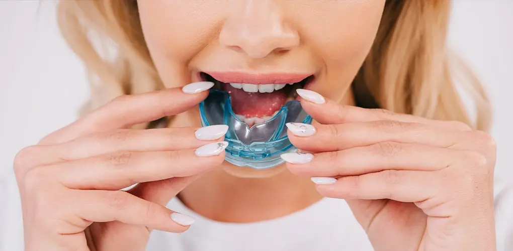 Do Kids Need Mouthguards A Parent’s Complete Guide