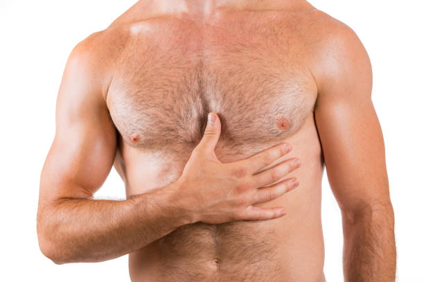 Does Gynecomastia Surgery Reduce Chest Fat Permanently