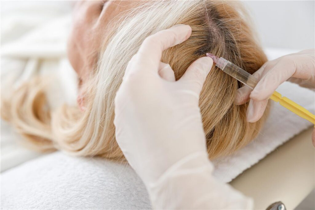 Does PRP Hair Treatment Strengthen Roots?