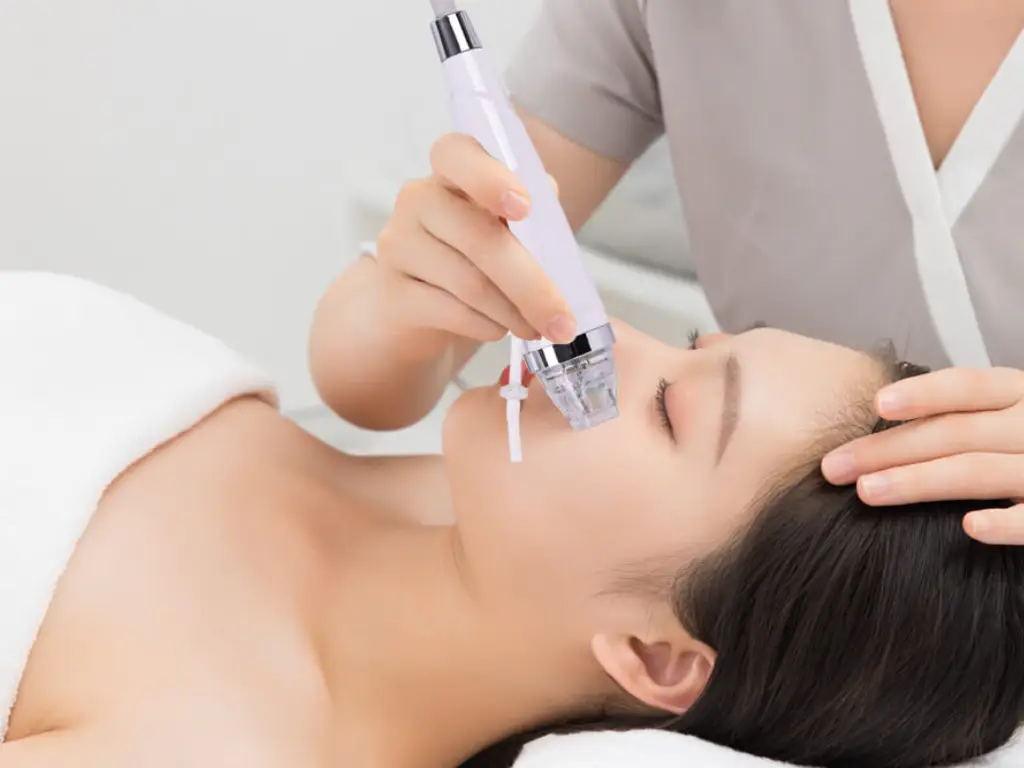 Experience Younger Looking Skin with RF Treatments