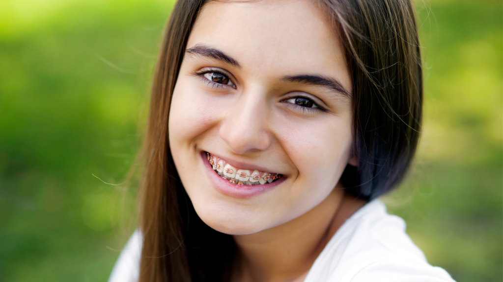 How Technology Has Revolutionized Braces Treatments