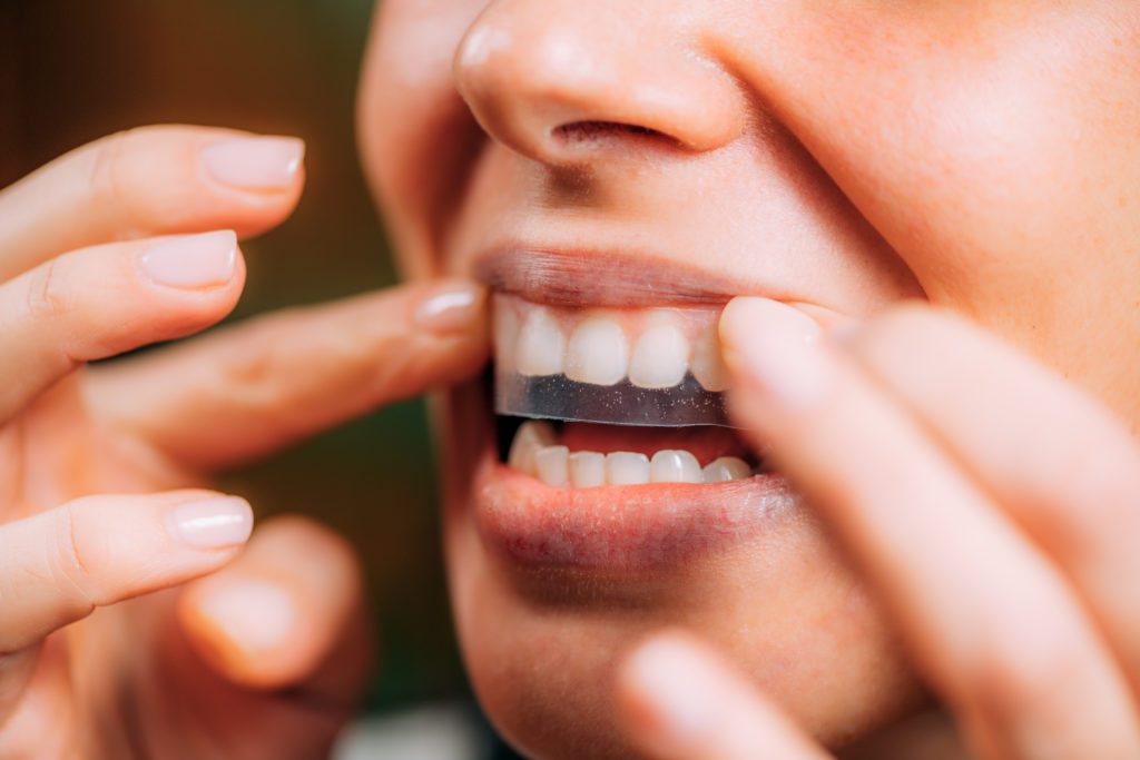 Is Teeth Whitening Treatment Safe During Pregnancy