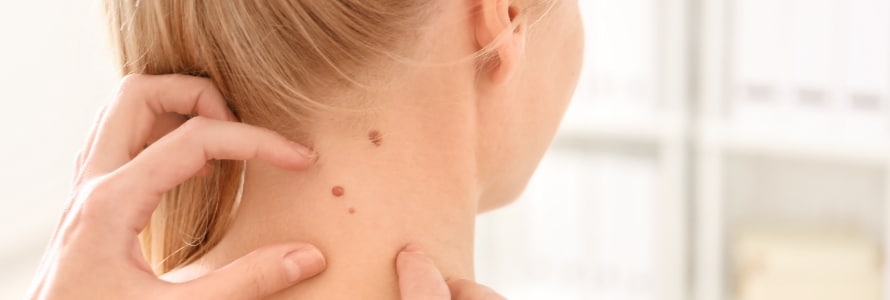 Latest Technology for Skin Lesion Treatments