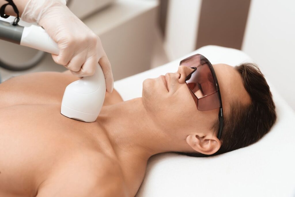 Male Laser Hair Removal