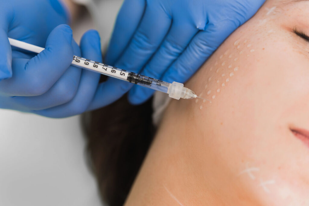Mesotherapy for Facial Contouring Non-Surgical Face Lift Options