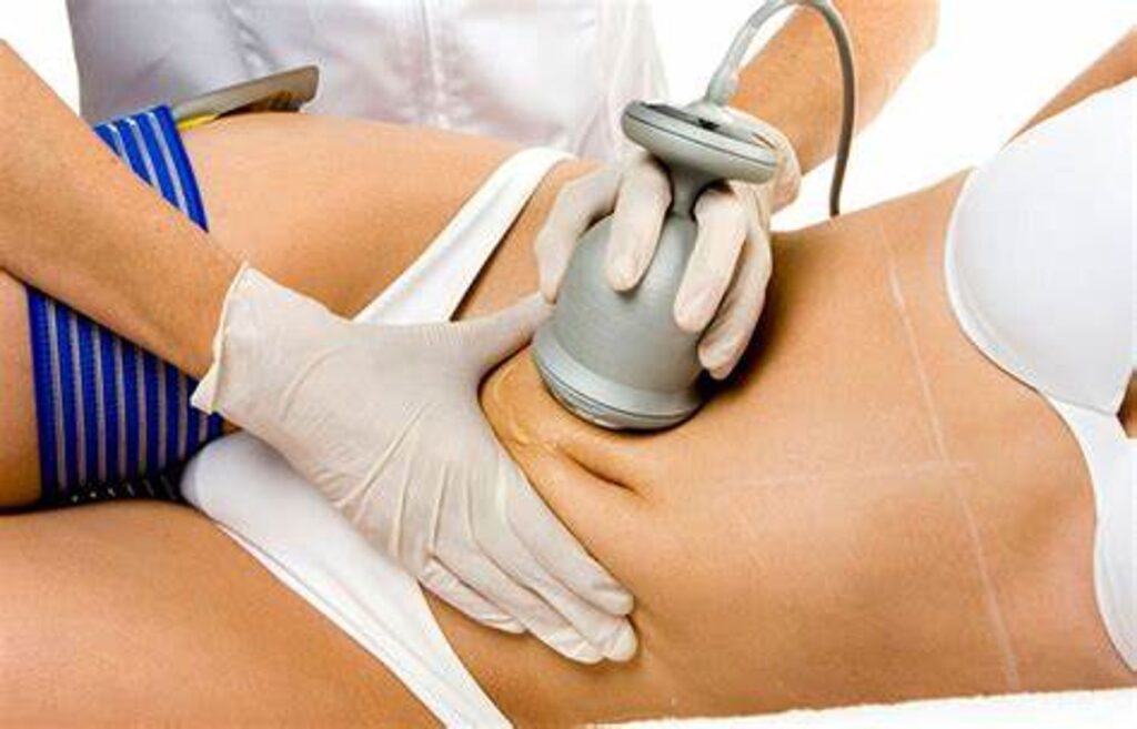 Personalized Body Contouring Solutions