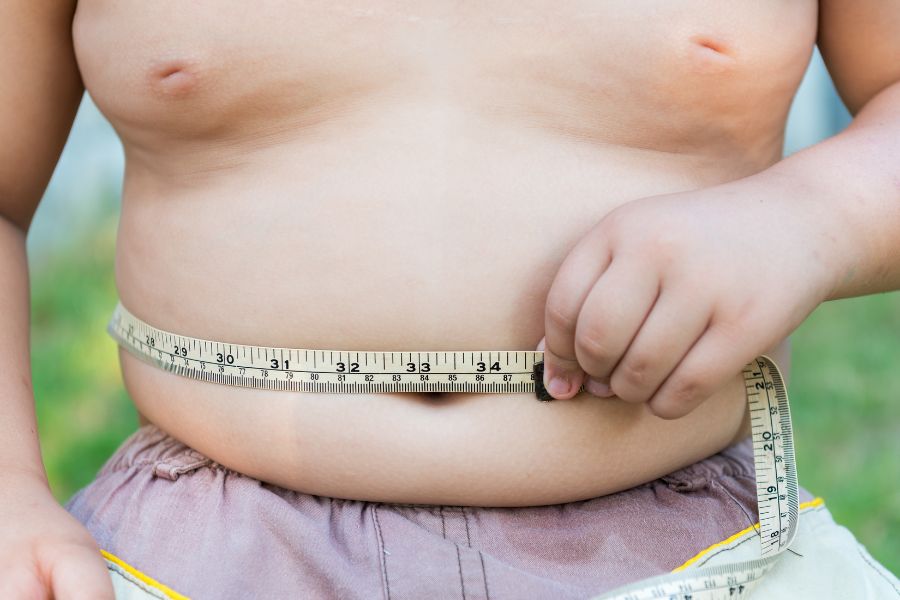 Personalized Sleeve Gastrectomy Plans