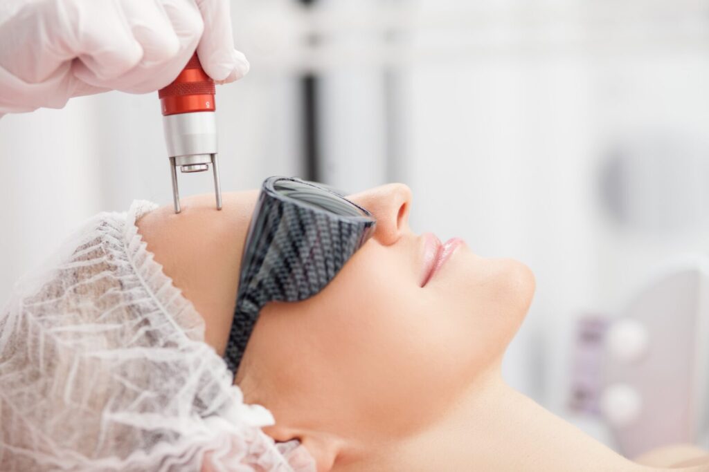 Pico Laser A Revolution in Skincare