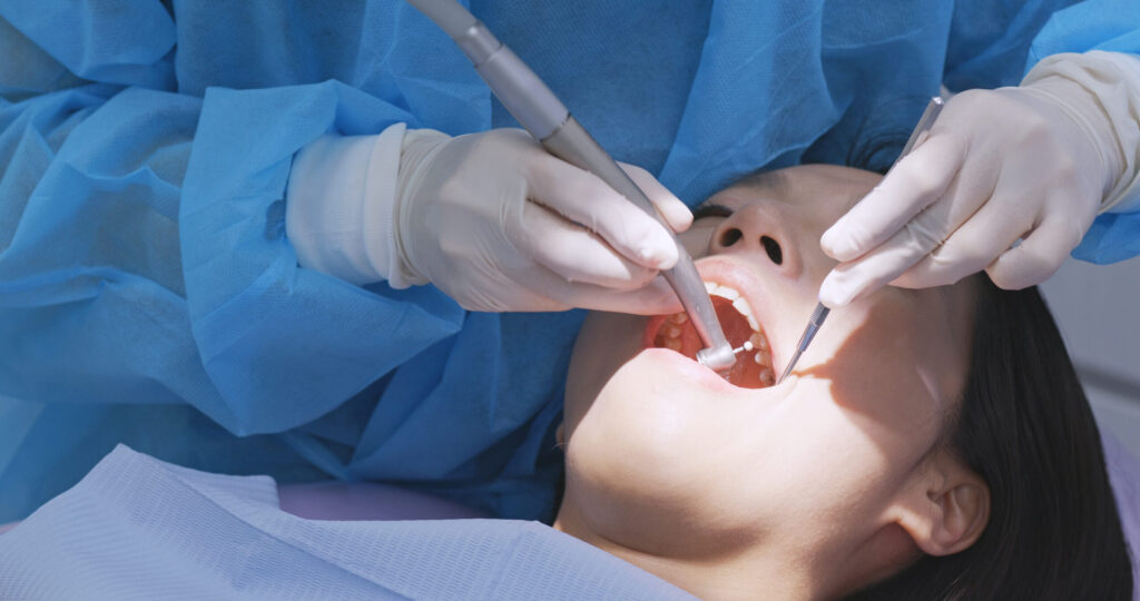 Preparing for Tooth Removal: A Step-by-Step Guide