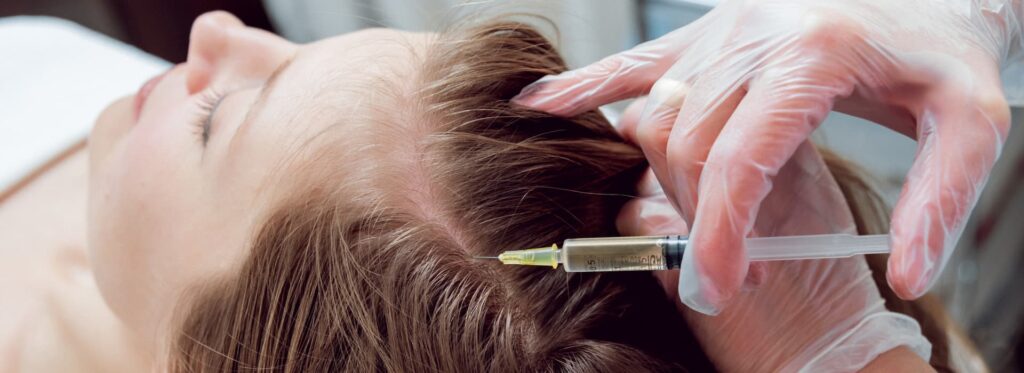 Restore Your Confidence with PRP Hair Treatment