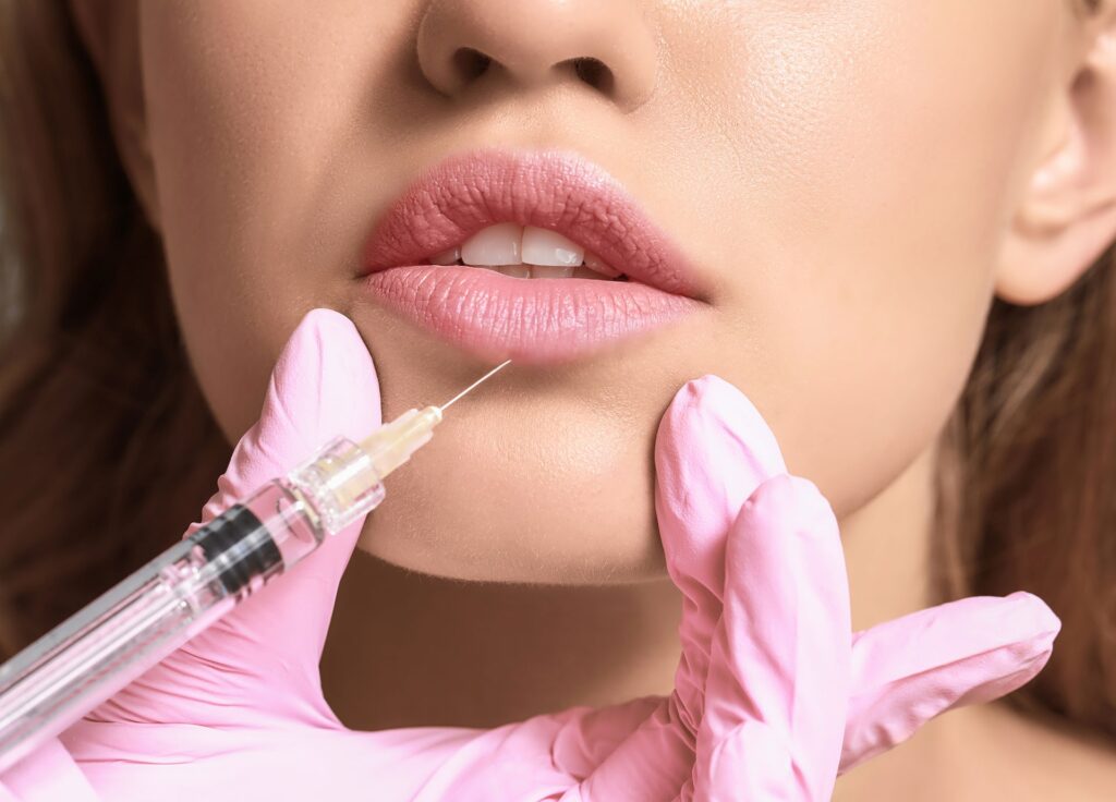Juvederm Fillers