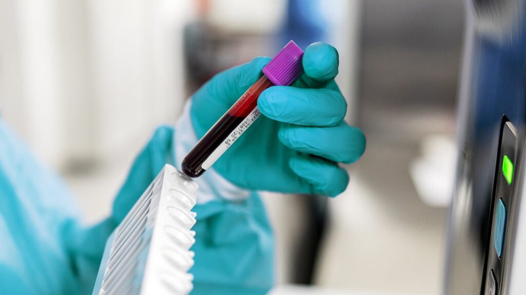 Blood Test at Home for Lyme Co-Infections: Can You Test at Home?