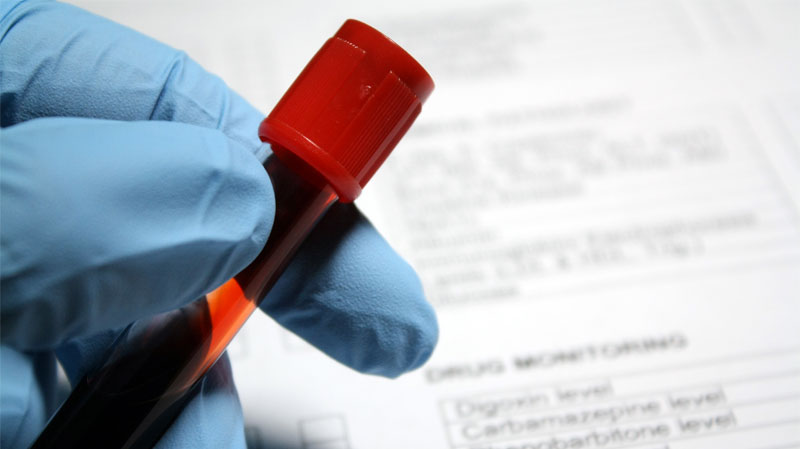 Blood Test at Home for Monitoring Hormone Replacement Therapy
