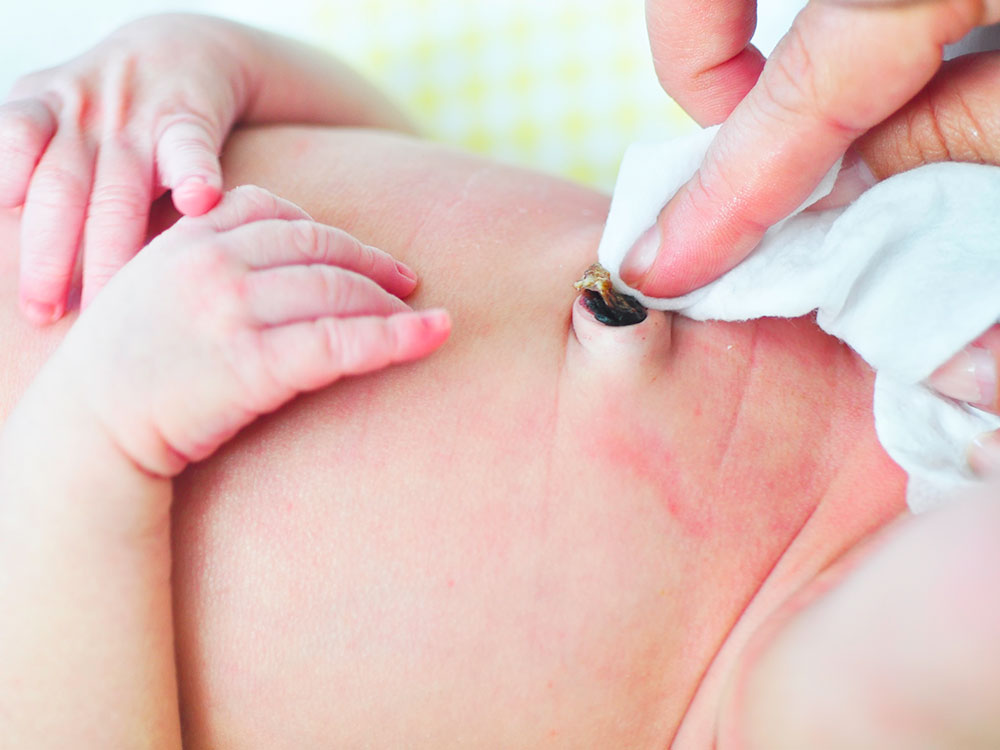 How a Home Nurse For Newborns Helps With Umbilical Cord Care
