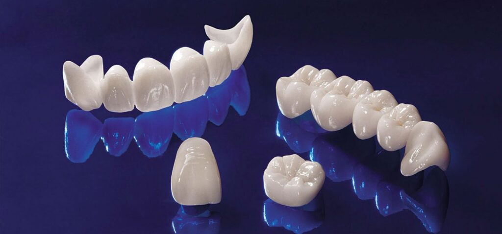 Dental Crowns and Bridges