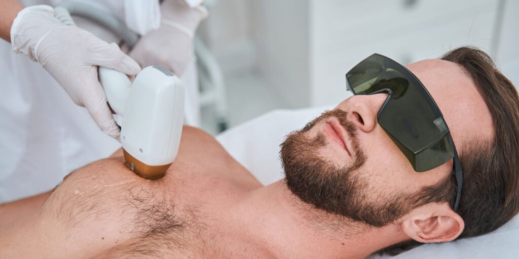 Male Laser Hair RemovaL