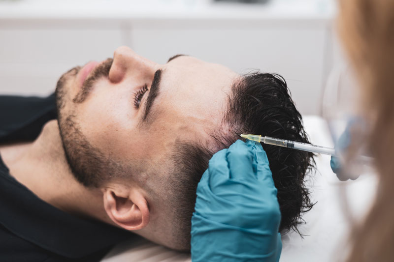 Best PRP Hair Treatment Proven Results You Can Trust