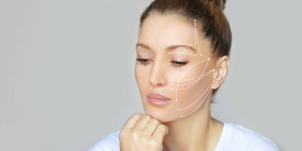 Can Thread Lift Reduce Wrinkles Around Eyes and Mouth