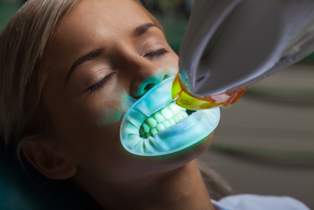 Common Mistakes to Avoid After Whitening Treatments