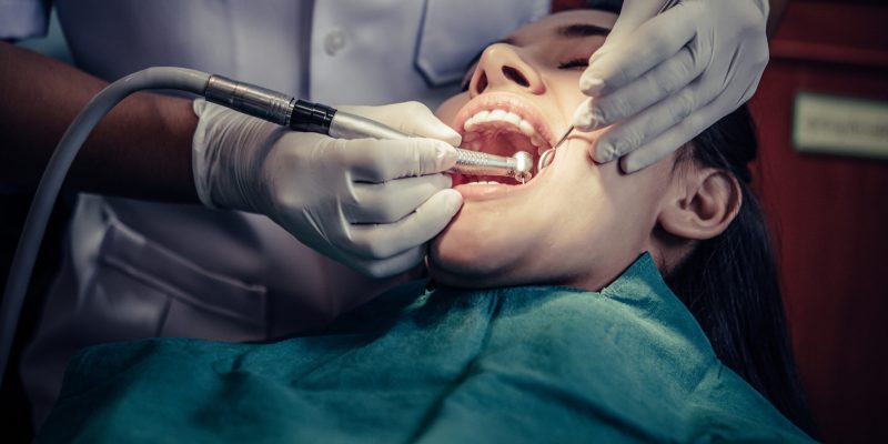 Common Myths About Wisdom Tooth Extraction Debunked