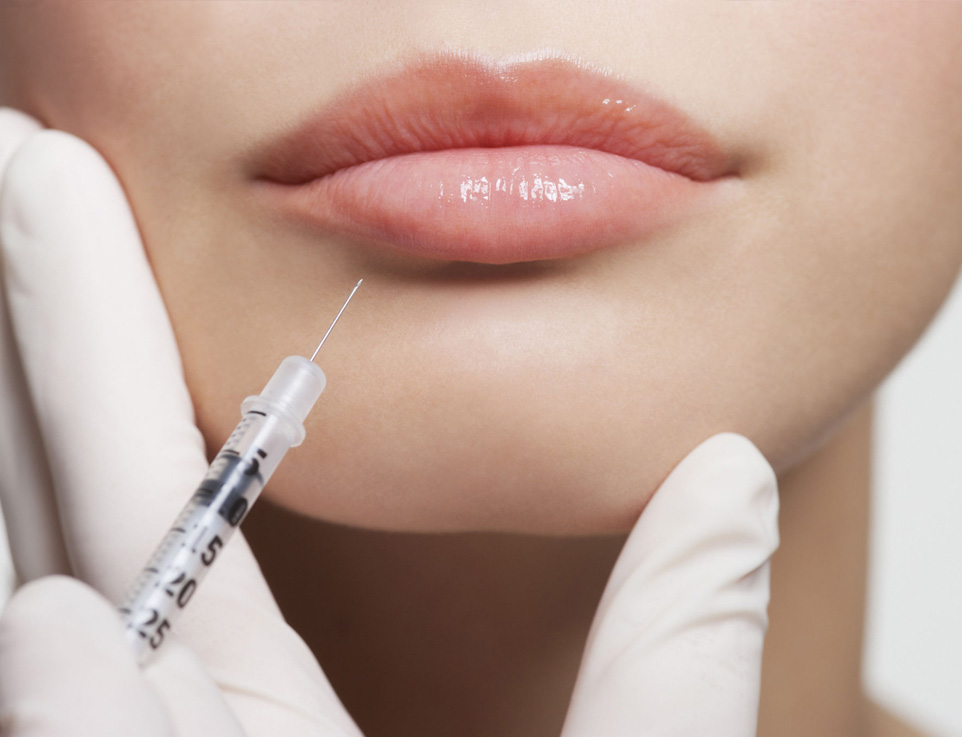 Get the Perfect Pout with Lip Fillers