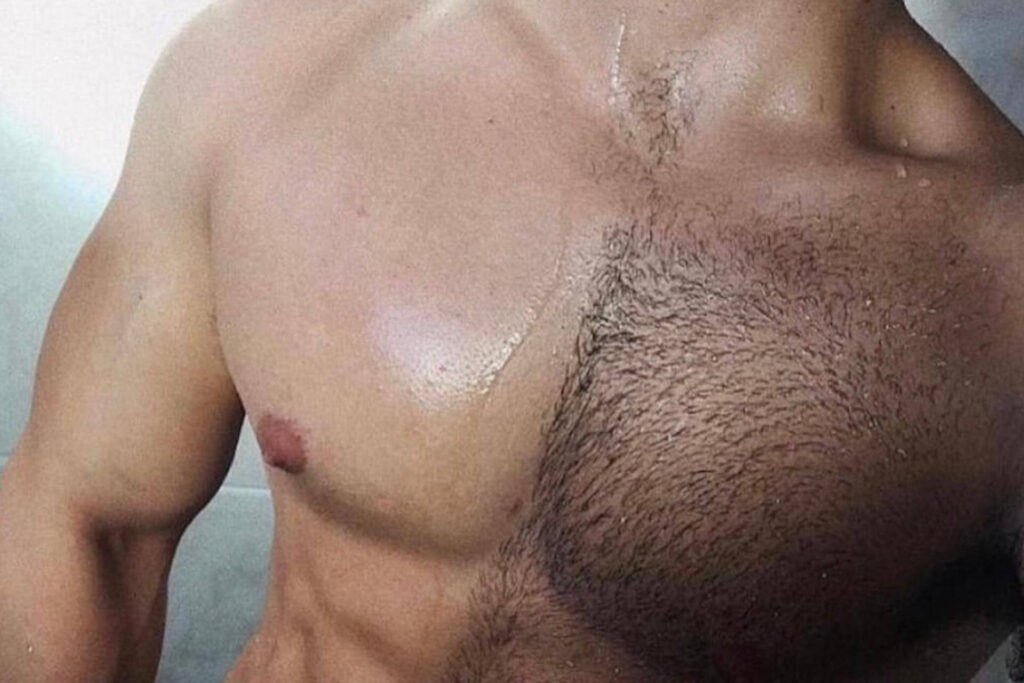 Laser Hair Removal Proven Results