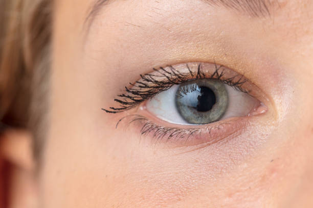 How Long Do Results of Eye Bag Removal Actually Last
