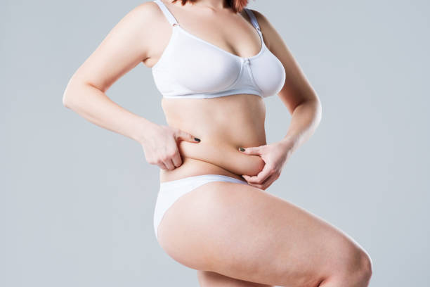 How Long Do Results of Fat Transfer Surgery Last