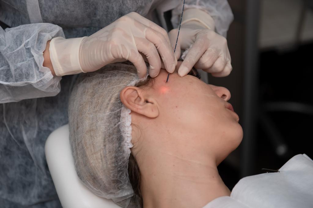 Is EndoLift Suitable for All Skin Types?