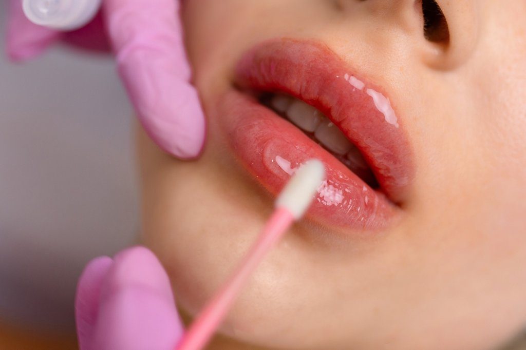 Lip Augmentation Safe and Effective Solutions