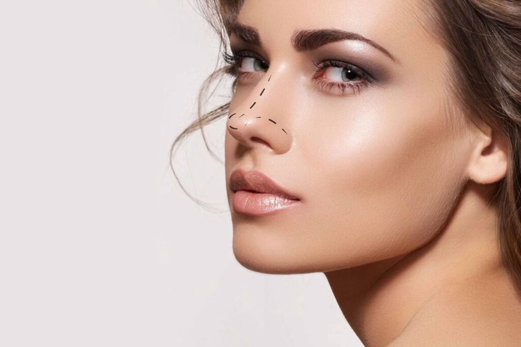 Rhinoplasty in Riyadh