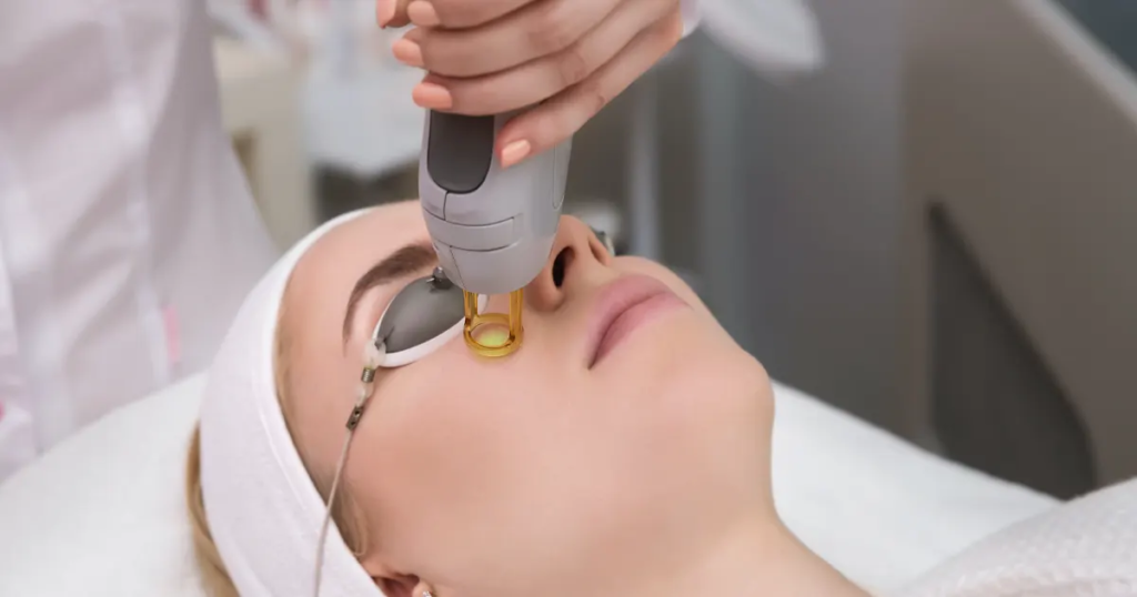 Safe and Non-Invasive Melasma Treatment